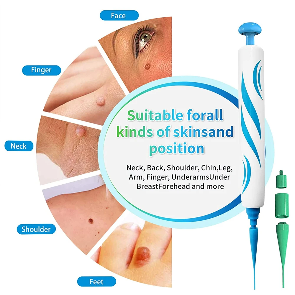 2 IN 1 Auto Micro Skin Tag Rem - Skincare Ingredients Checker บทวิจารณ์และราคา