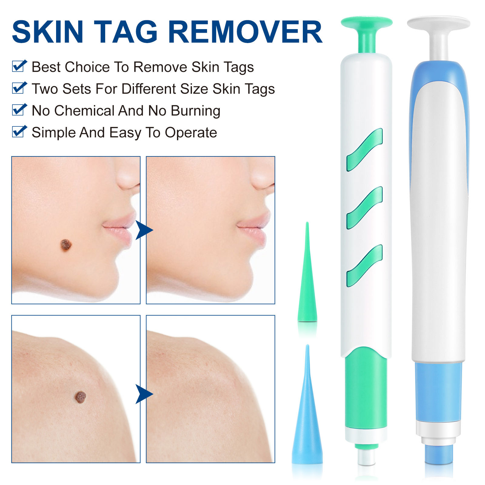 2-IN-1 Auto Skin Tag Removal K - Skincare Ingredients Checker บทวิจารณ์และราคา