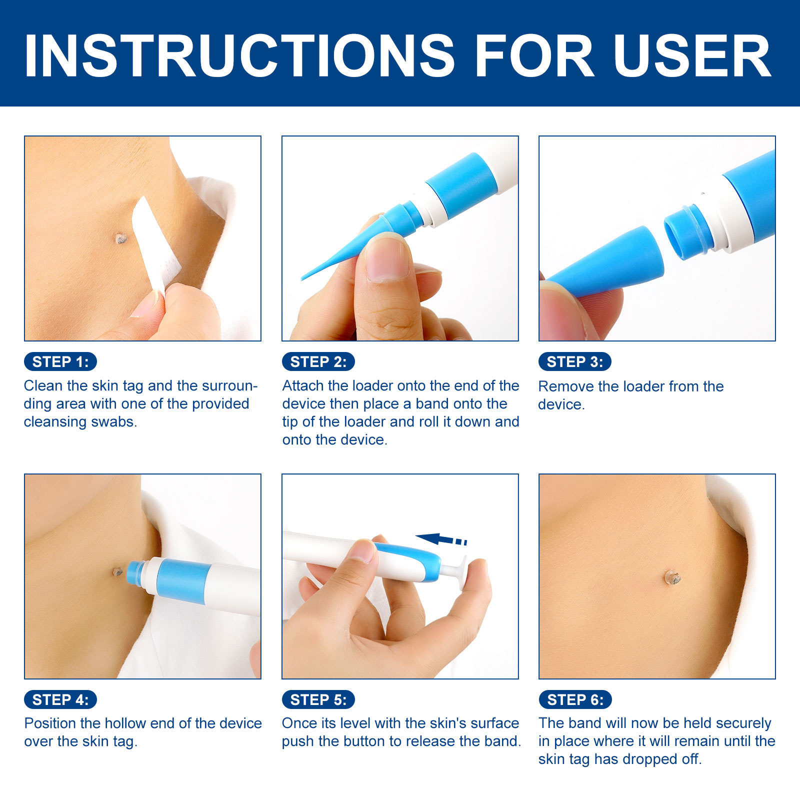 2-IN-1 Auto Skin Tag Removal K - Skincare Ingredients Checker บทวิจารณ์และราคา